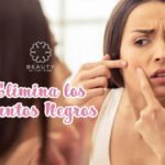 Cómo eliminar los puntos negros puntos negros